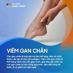 Viêm cân gan chân 1
