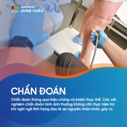 Viêm cân gan chân 5