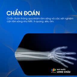 Viêm gân cơ nhị đầu 5