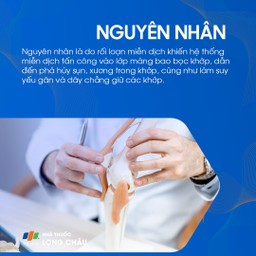 Viêm đa khớp dạng thấp 3