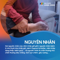 Viêm khớp gối 3