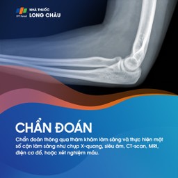 Viêm khớp khuỷu tay 5