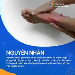 Viêm khớp mạn tính 3