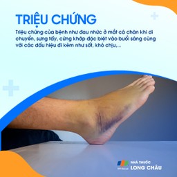 Viêm khớp mắt cá chân 3