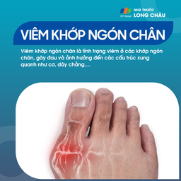 Viêm khớp ngón chân 1