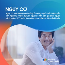 Viêm khớp vảy nến 5