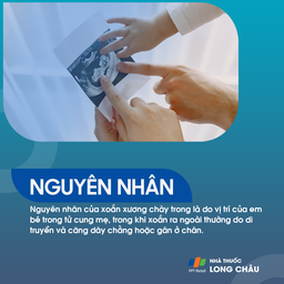 Xoắn xương chày 3