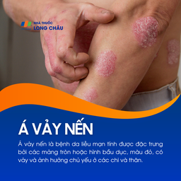 Á vảy nến 1