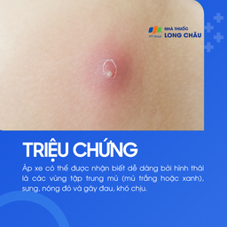 Áp xe thường xuất hiện dưới dạng vùng da sưng đỏ, nóng và có mủ trắng hoặc xanh, gây đau