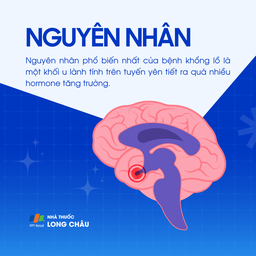 Bệnh khổng lồ 3