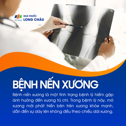 Bệnh nến xương 1