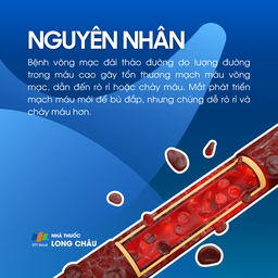 Bệnh võng mạc tiểu đường 3