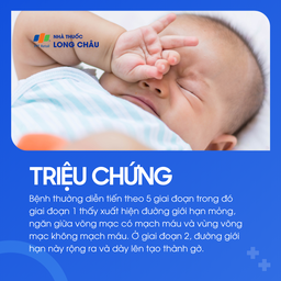 Bong võng mạc trẻ sinh non 2