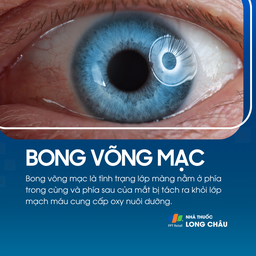 Tình trạng tách lớp võng mạc khỏi mạch máu phía sau mắt – nguy cơ mất thị lực