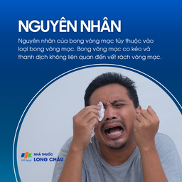 Do co kéo võng mạc, thanh dịch, không liên quan vết rách