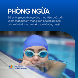 Khám mắt định kỳ, đeo kính bảo hộ, kiểm soát đường huyết