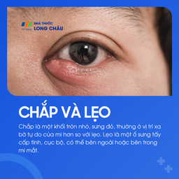 Chắp là khối tròn nhỏ, không nhiễm trùng. Lẹo là ổ viêm cấp tính, có thể bên trong hoặc bên ngoài mí mắt