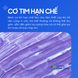 Cơ tim hạn chế 1