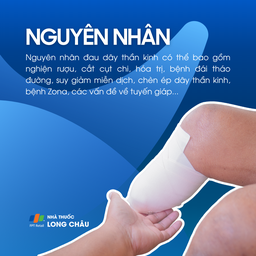 Đau dây thần kinh 3