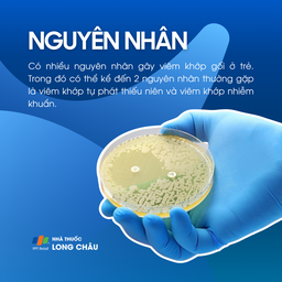 Viêm khớp gối ở trẻ em 3