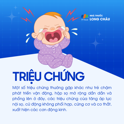 Dị tật Dandy-Walker 2