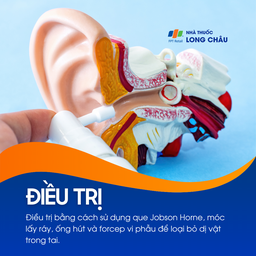 Dị vật trong tai 6