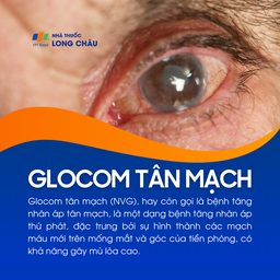 Glocom tân mạch 1