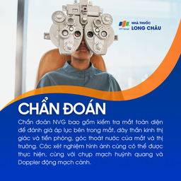 Glocom tân mạch 5