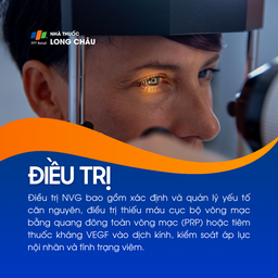 Glocom tân mạch 6