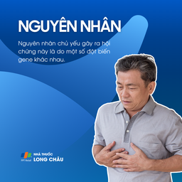 Hội chứng Brugada 3