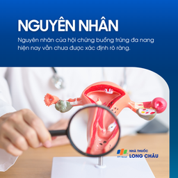 Hội chứng buồng trứng đa nang 3