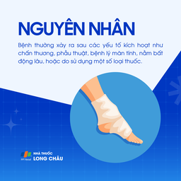 Hội chứng sudeck 3