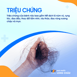Mất kinh 2