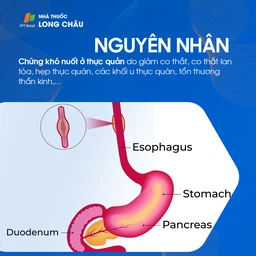 Chứng khó nuốt 