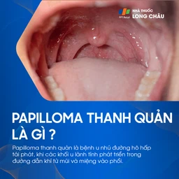 Papilloma thanh quản là gì? Bệnh u nhú đường hô hấp tái phát