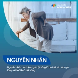 Gai cột sống 3