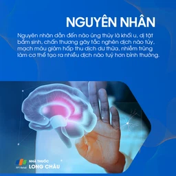Não úng thủy 3
