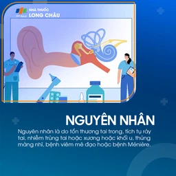 Suy giảm thính lực 3