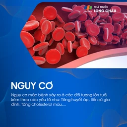 Thiểu năng tuần hoàn não 4
