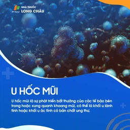 U hốc mũi 1