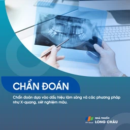 Viêm quanh răng 5