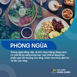 Viêm quanh răng 7