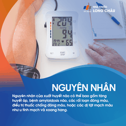 Xuất huyết não 3