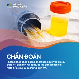 Bỏng da 6