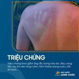 Bỏng nắng 2