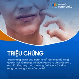 Chốc lở 2