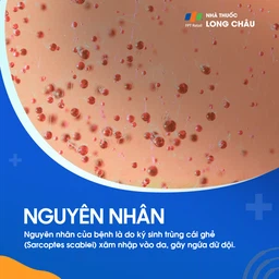 Ghẻ 3