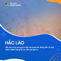 Hắc lào 1
