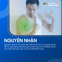 Hôi Nách 3