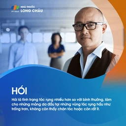 Hói 1